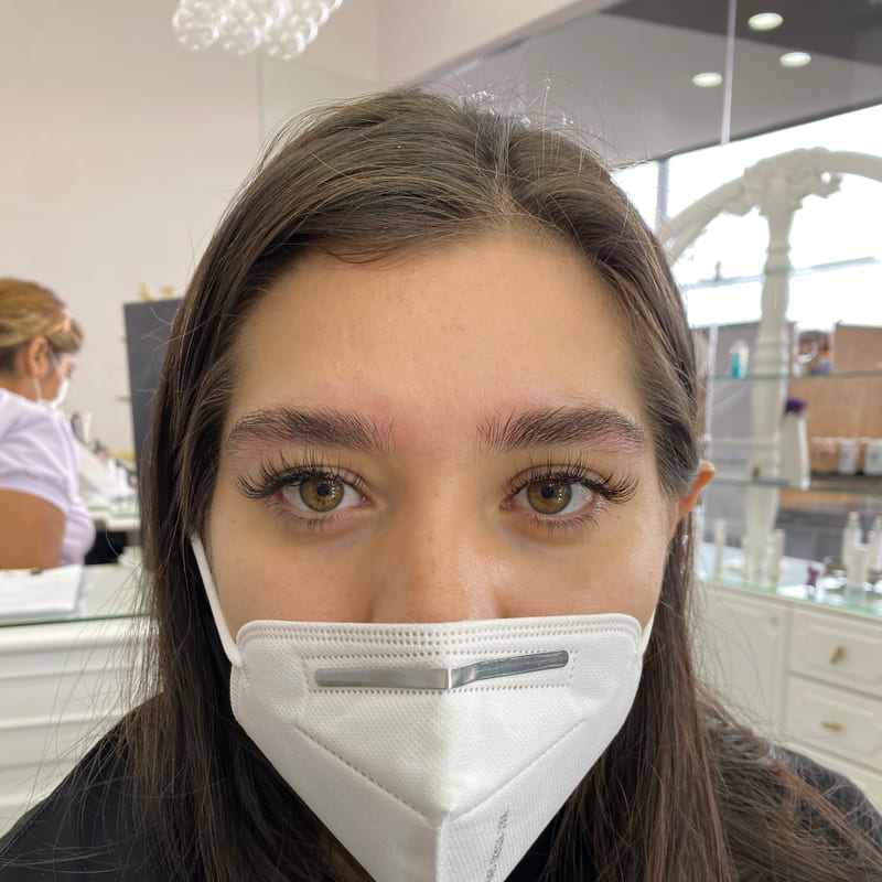 Defined lash line, healed.