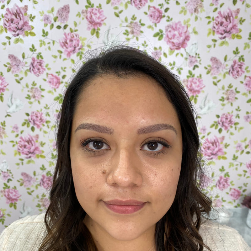 Natural hair strokes, healed at six weeks.